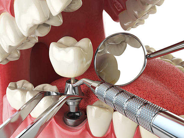 Best Tooth Pain Emergency Relief  in Quanah, TX